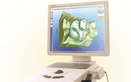 CEREC3