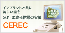 CEREC